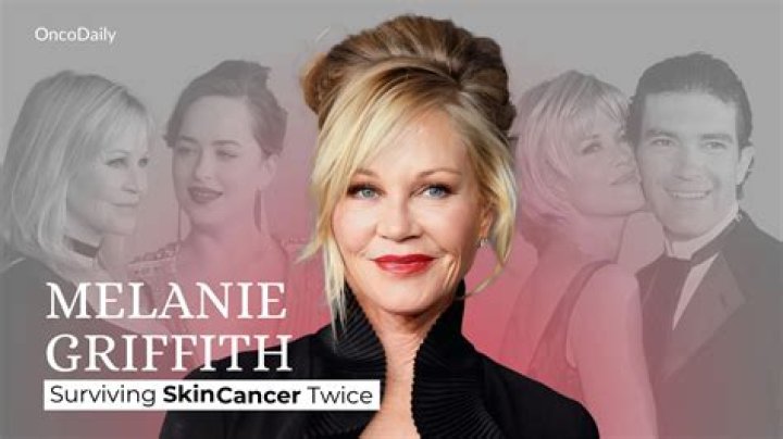 Unveiling The Truths About Melanie Griffith's Cancer Journey: Discoveries And Insights